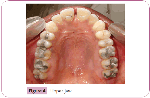 Annals-Clinical-Laboratory-Upper-jaw
