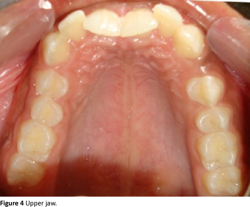 Annals-Clinical-Laboratory-Upper-jaw