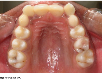 Annals-Clinical-Laboratory-Upper-jaw