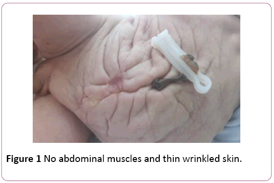 Annals-Clinical-Laboratory-abdominal-muscles