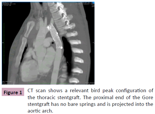 Annals-Clinical-Laboratory-bird-peak-configuration