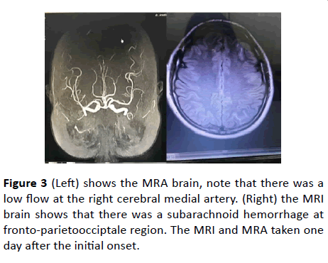 Annals-Clinical-Laboratory-cerebral-medial-artery