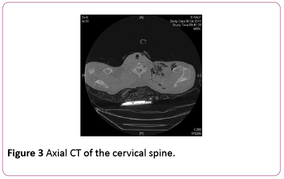 Annals-Clinical-Laboratory-cervical-spine