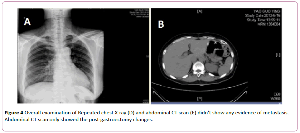 Annals-Clinical-Laboratory-chest-X-ray