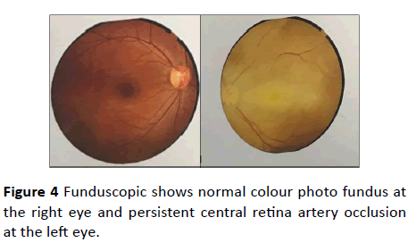 Annals-Clinical-Laboratory-colour-photo-fundus