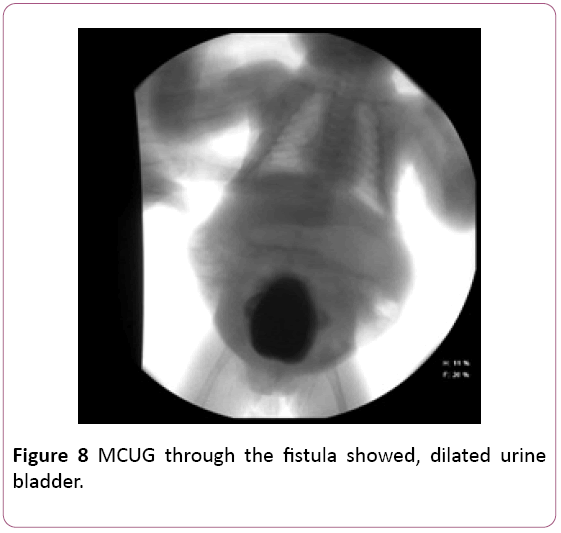 Annals-Clinical-Laboratory-dilated-urine