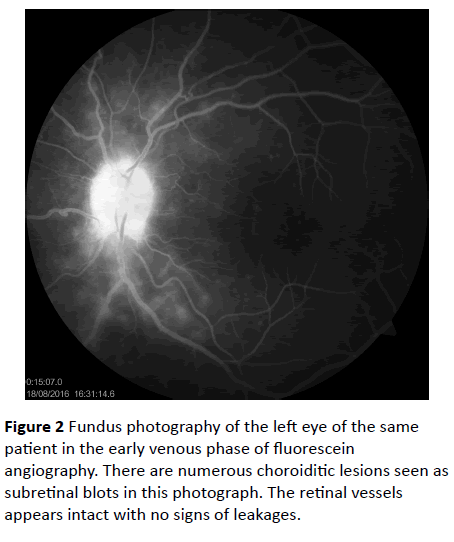 Annals-Clinical-Laboratory-fluorescein-angiography