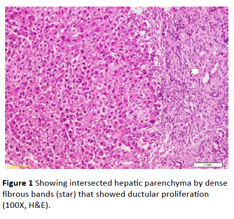 Annals-Clinical-Laboratory-hepatic-parenchyma