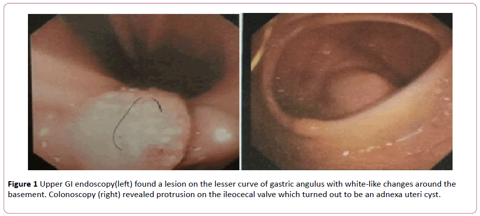 Annals-Clinical-Laboratory-lesser-curve-gastric-angulus