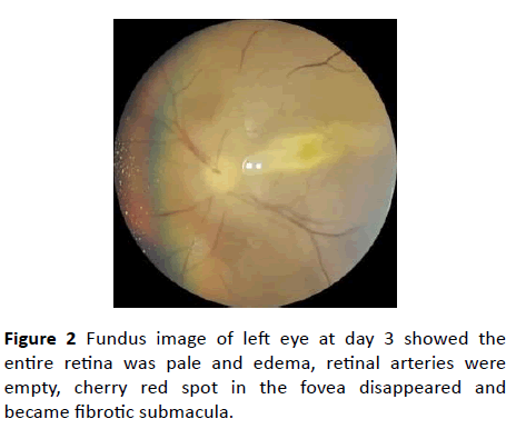 Annals-Clinical-Laboratory-retinal-arteries
