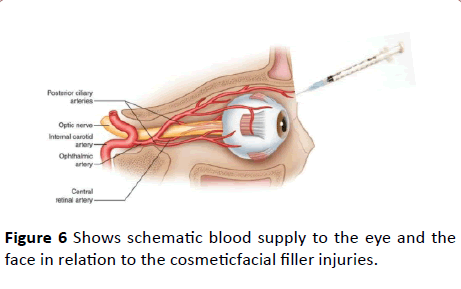 Annals-Clinical-Laboratory-schematic-blood