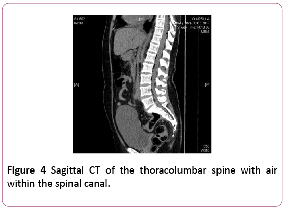 Annals-Clinical-Laboratory-thoracolumbar-spine