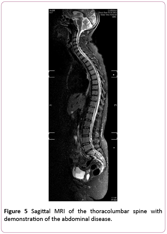 Annals-Clinical-Laboratory-thoracolumbar-spine