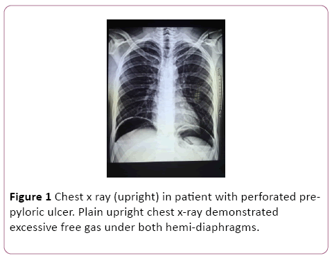 Annals-Clinical-Laboratory-unable-hemi-diaphragms