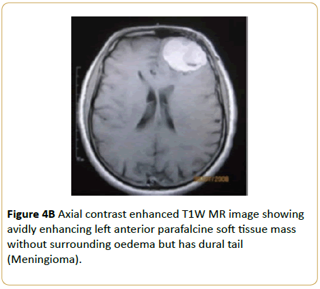 Archives-Cancer-Research-Axial-contrast