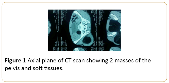 Archives-Cancer-Research-Axial-plane