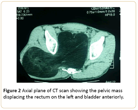 Archives-Cancer-Research-Axial-plane