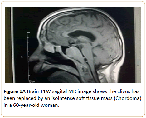 Archives-Cancer-Research-Brain-sagital