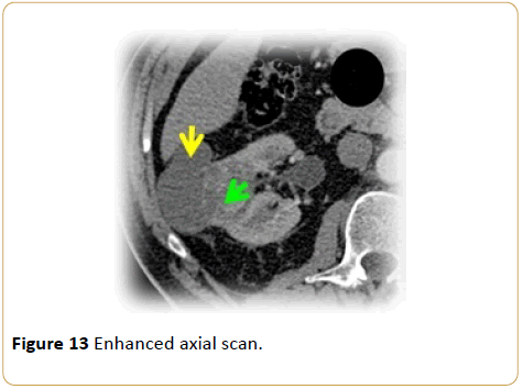 Archives-Cancer-Research-Enhanced-axial-scan