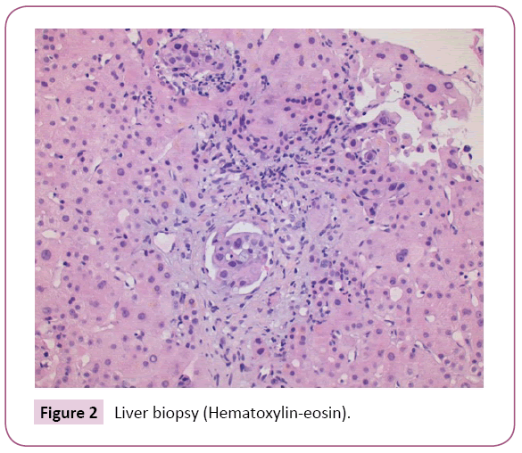 Archives-Cancer-Research-Hematoxylin-eosin