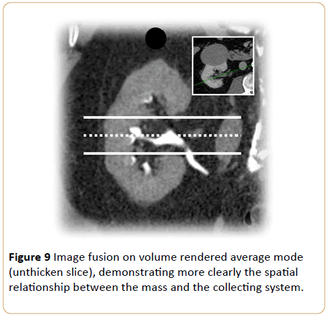 Archives-Cancer-Research-Image-fusion