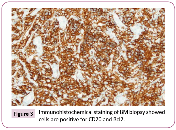 Archives-Cancer-Research-Immunohistochemical-staining
