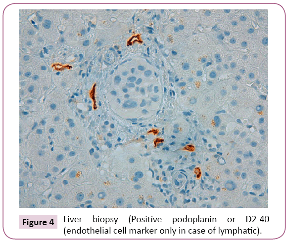 Archives-Cancer-Research-Liver-biopsy