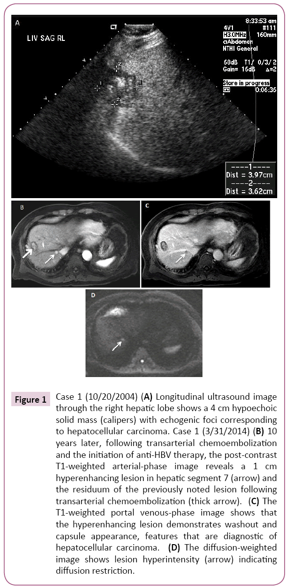 Archives-Cancer-Research-Longitudinal-ultrasound