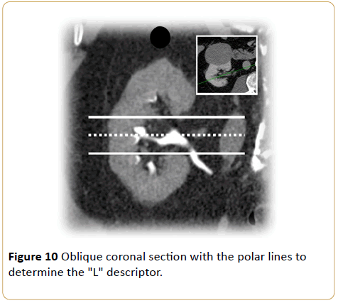 Archives-Cancer-Research-Oblique-coronal