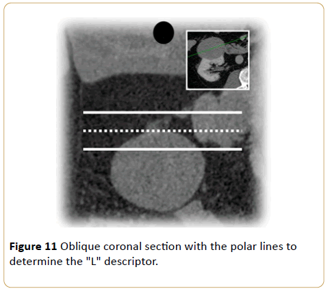 Archives-Cancer-Research-Oblique-coronal