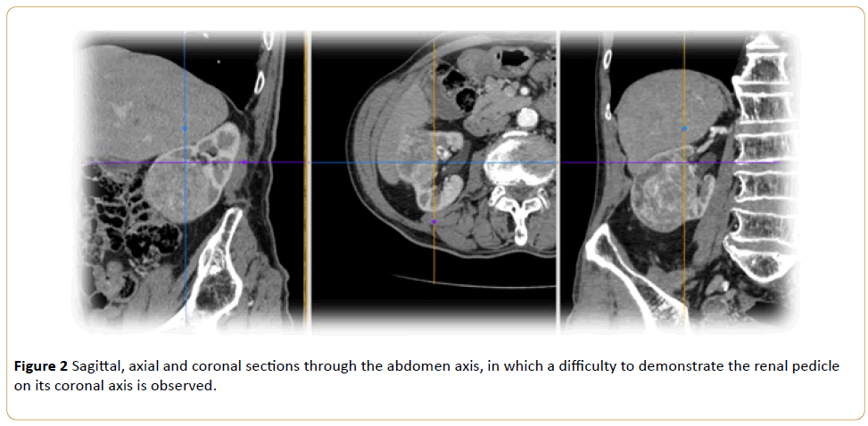 Archives-Cancer-Research-Sagittal-abdomen