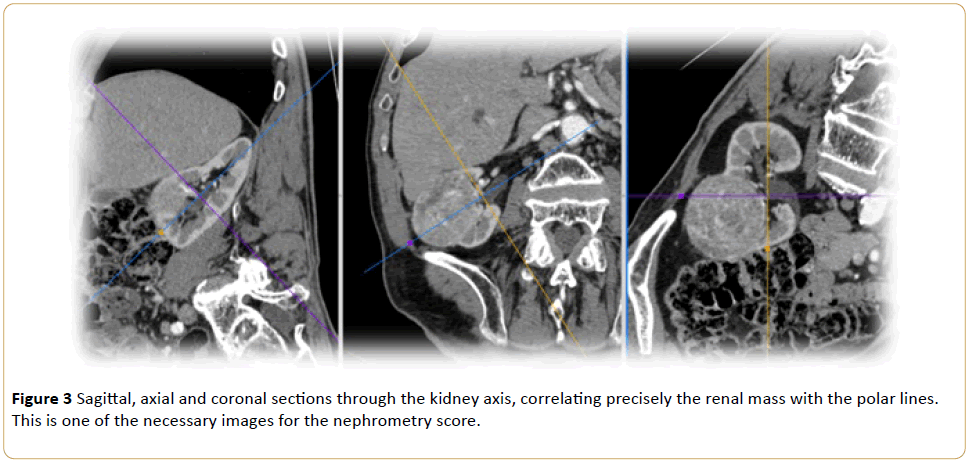 Archives-Cancer-Research-Sagittal-kidney