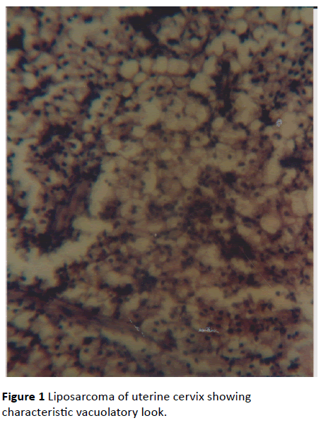 Archives-Cancer-Research-characteristic-vacuolatory