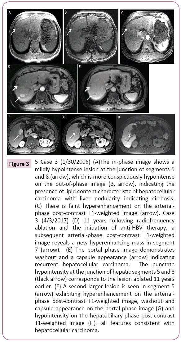 Archives-Cancer-Research-conspicuously-hypointense