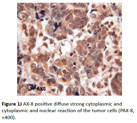 Archives-Cancer-Research-cytoplasmic-nuclear