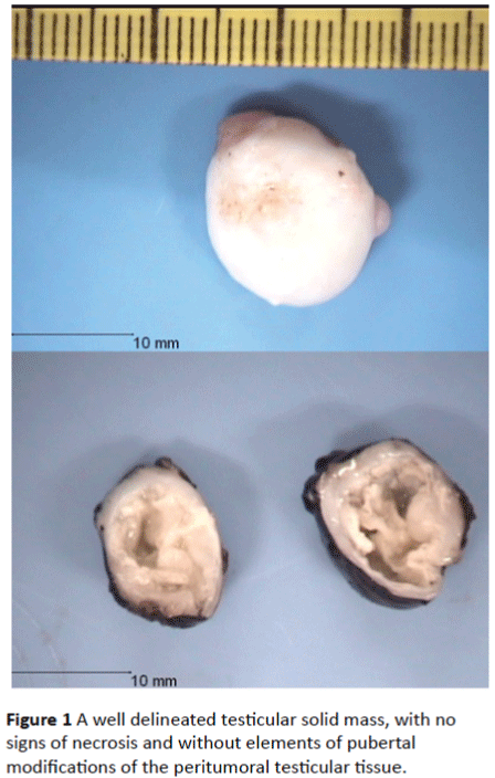 Archives-Cancer-Research-delineated-testicular