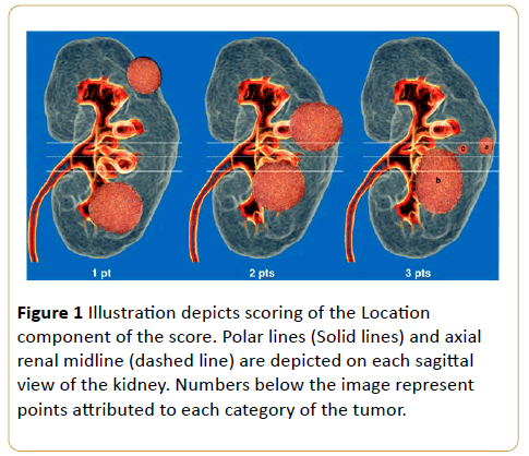 Archives-Cancer-Research-depicts-scoring