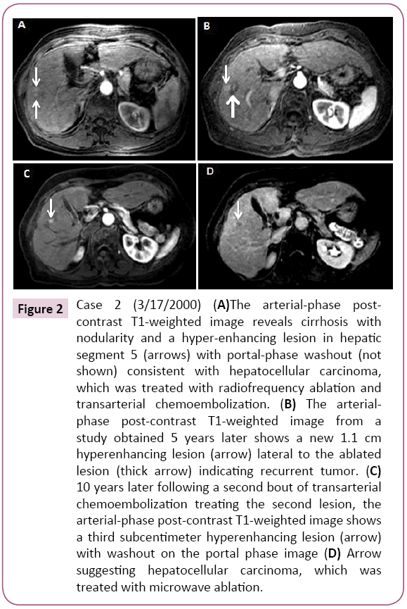 Archives-Cancer-Research-hyper-enhancing