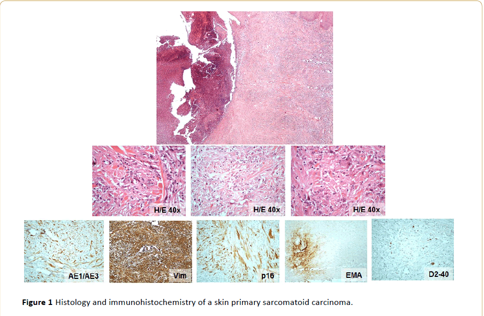 Archives-Cancer-Research-immunohistochemistry