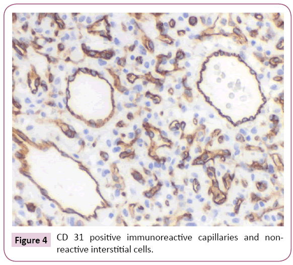 Archives-Cancer-Research-interstitial-cells