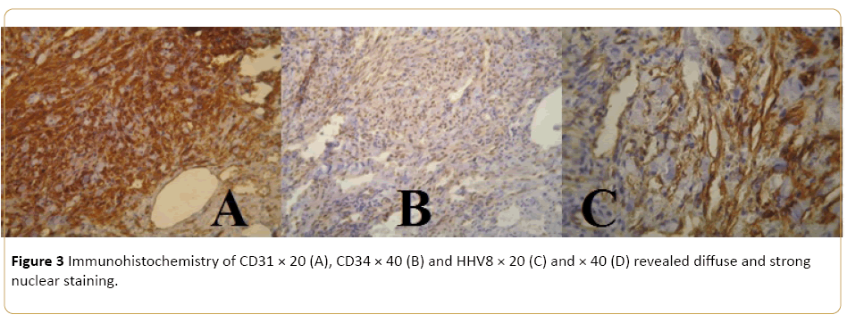 Archives-Cancer-Research-nuclear-staining