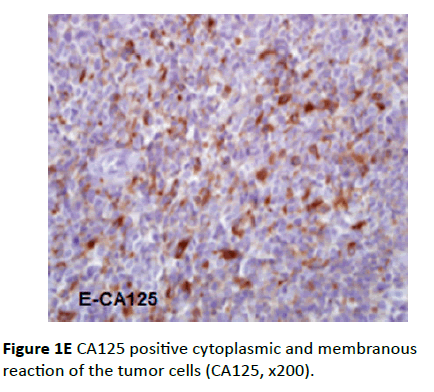 Archives-Cancer-Research-positive-cytoplasmic