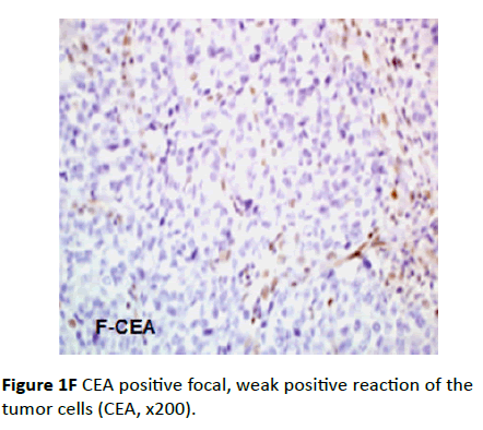 Archives-Cancer-Research-positive-reaction