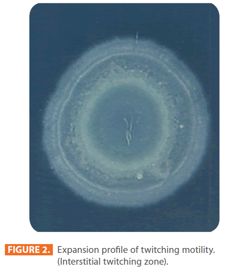 Archives-Clinical-Microbiology-Expansion-profile-twitching