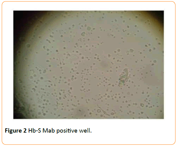 Archives-Clinical-Microbiology-Hb-S-Mab-positive-well