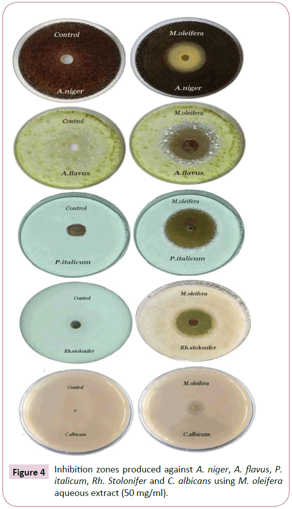 Archives-Clinical-Microbiology-Inhibition-zones-produced