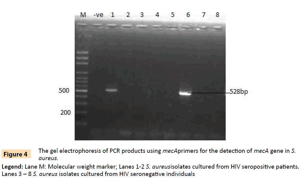 Archives-Clinical-Microbiology-Molecular-weight-marker