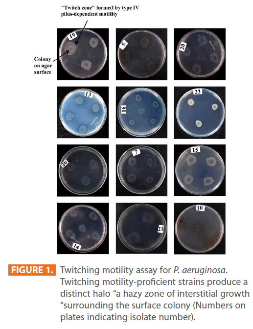 Archives-Clinical-Microbiology-Twitching-motility-assay