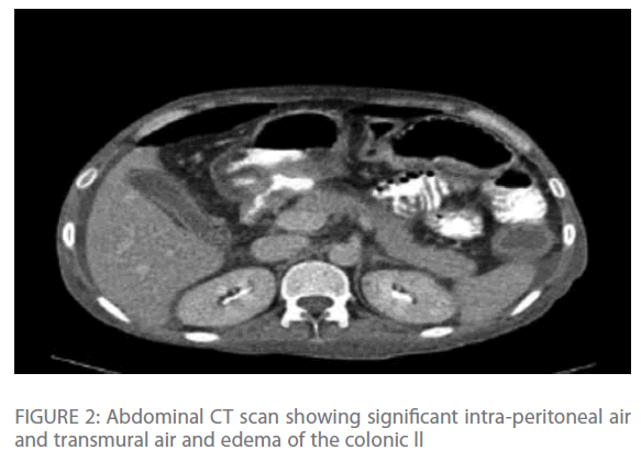 Archives-Clinical-Microbiology-air-edema-colonic