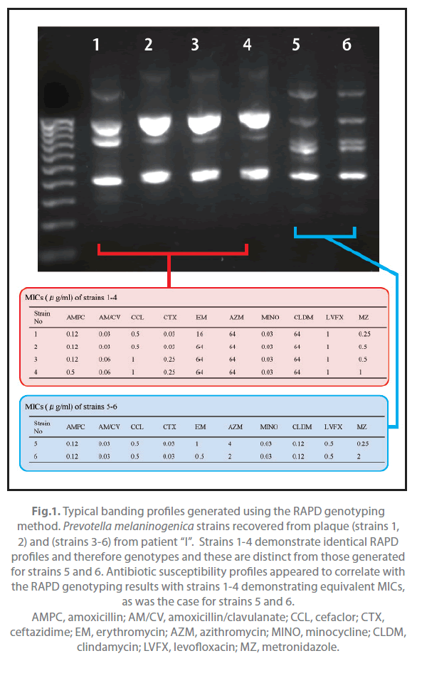 Archives-Clinical-Microbiology-banding-profiles-generated